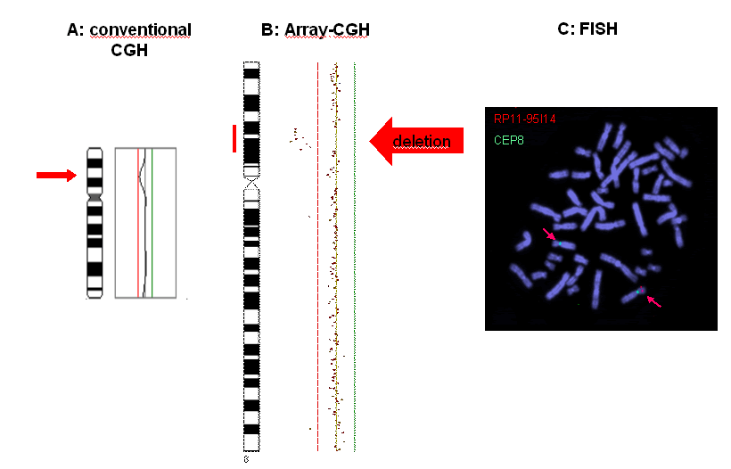 Array-CGH