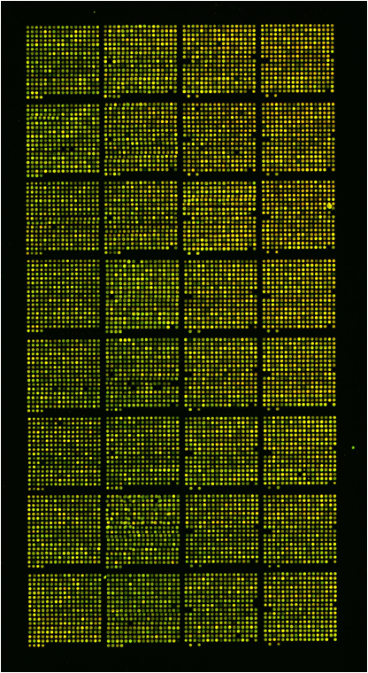 안습 Array  Comparative Genomic Hybridization