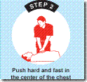 Hands-Only CPR