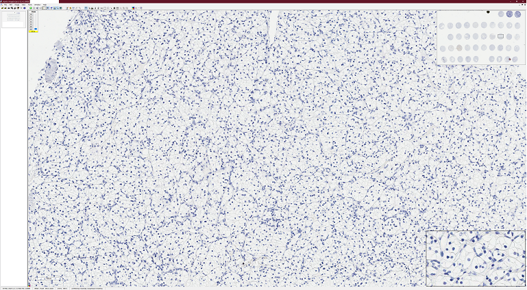 Aperio ImageScope